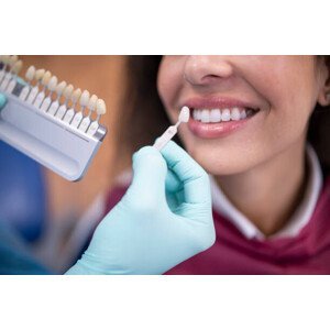 Umělecká fotografie Dentist using a palette tooth color sample., ArtistGNDphotography, (40 x 26.7 cm)