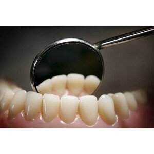 Umělecká fotografie Dentists Offering NHS Treatment Continue To, Peter Macdiarmid, ( x  cm)